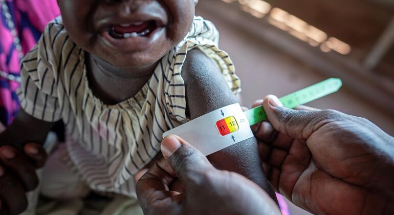 Медицинский работник измеряет окружность руки ребенка: так определяется уровень истощения.